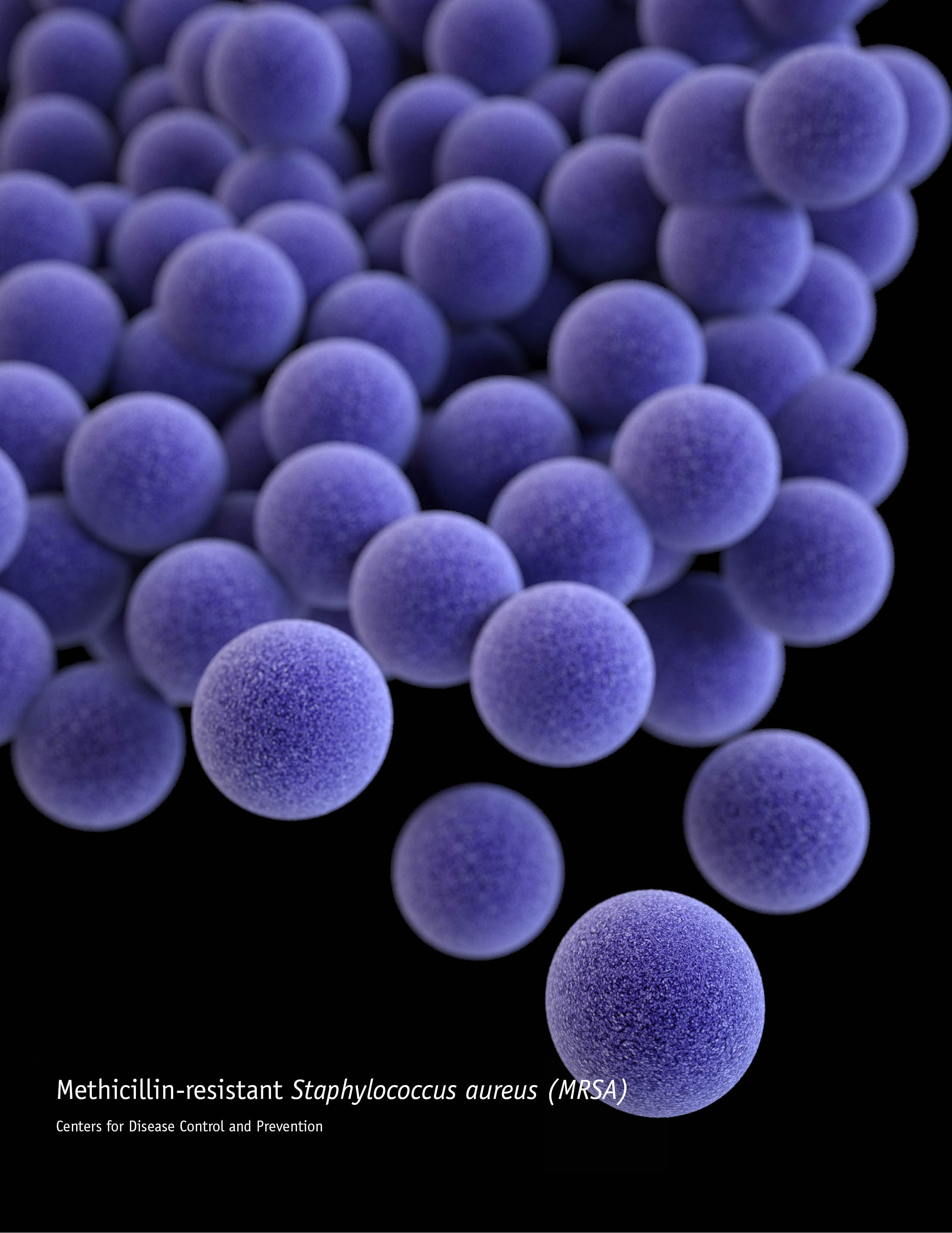  An artistic recreation of MRSA. Michigan State University researcher Xuefei Huang is applying cutting-edge vaccine science in the fight against antibiotic resistance.   Credit: Jennifer Oosthuizen, medical illustrator. Centers for Disease Control and Prevention Public Health Image Library. 