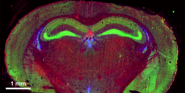 Preliminary quantitative elemental maps of the mouse coronal brain. Green regions correspond to high concentrations of Zn, especially prevalent in  the  hippocampal  formation.  Blue  regions  correspond to Cu enrichment in periventricular zones  (also  enriched  in  stem  cells),  and  red  areas indicate Fe abundance (Kozorovitskiy and O'Halloran, unpublished data).
